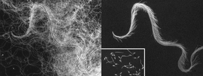 (Click image to enlarge) This is an image of a sperm conjugate from the diving beetle, Hygrotus sayi. It is a composite image with three images taken at the same magnification. On the left is a darkfield image showing both sperm heads and tails. On the right is the same conjugate viewed using epifluorescence, showing the heads only. The inset shows an epifluorescence image (heads only) of two different types of sperm that together form the conjugate. Photo: D. Higginson (Click image to enlarge) This is an image of a sperm conjugate from the diving beetle, Hygrotus sayi. It is a composite image with three images taken at the same magnification. On the left is a darkfield image showing both sperm heads and tails. On the right is the same conjugate viewed using epifluorescence, showing the heads only. The inset shows an epifluorescence image (heads only) of two different types of sperm that together form the conjugate. Photo: D. Higginson